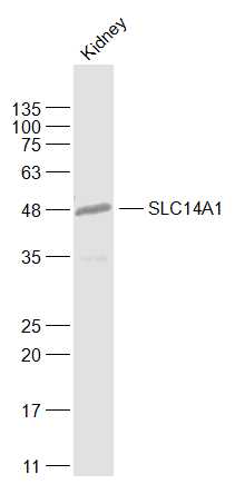 SLC14A1 antibody