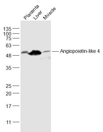ANGPTL4 antibody
