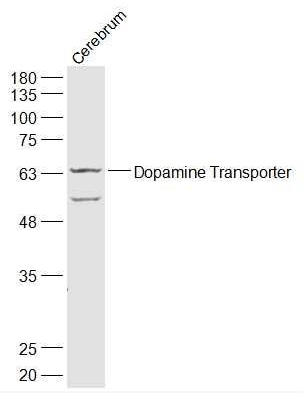 Dopamine Transporter antibody