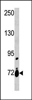 SLC28A1 antibody