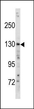TSC1 antibody