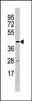 TTC5 antibody