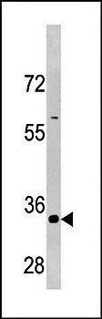 CCNB3 antibody