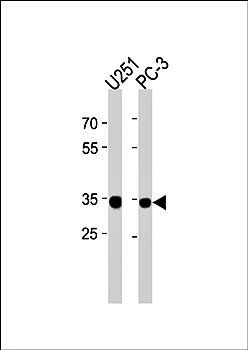 RPLP0P6 antibody