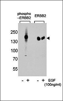 Phospho-ERBB2-Y877 antibody