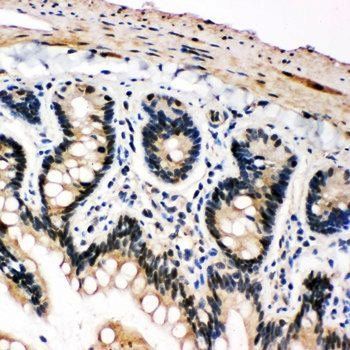 Anti-PLK2 Antibody