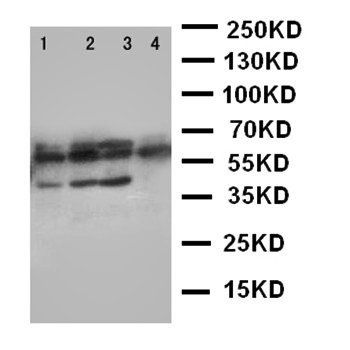 Parathyroid Hormone Receptor 1/PTH1R Antibody