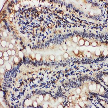 Anti-VCP Antibody