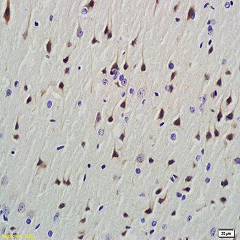 HLA-A Rabbit Polyclonal Antibody (HRP)