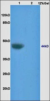 HLA-A Rabbit Polyclonal Antibody (HRP)
