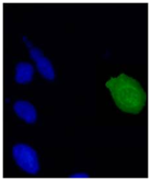 Mouse monoclonal antibody to HPV-18 E7
