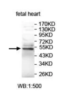 Anti-ISLR