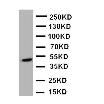 Anti-Beta Arrestin 2/ARRB2 Antibody