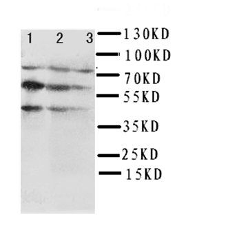 Anti-Beclin 1/BECN1 Antibody