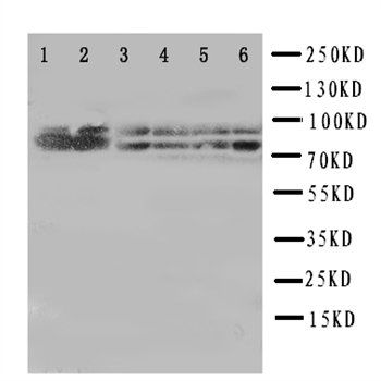 B Raf/BRAF Antibody