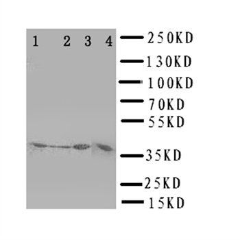 Anti-CD1d Antibody