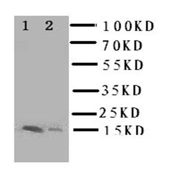 Fatty Acid Binding Protein 5/FABP5 Antibody