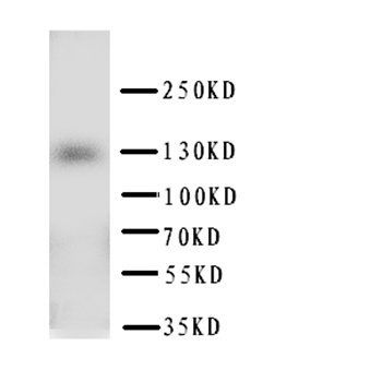 Anti-PTCH2 Antibody