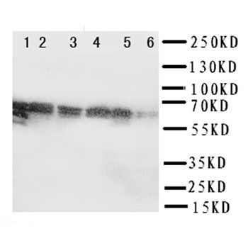 Anti-splicing factor 1/SF1 Antibody