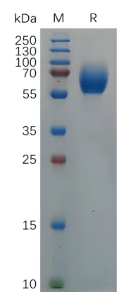 Cynomolgus IL18BP Protein, hFc Tag