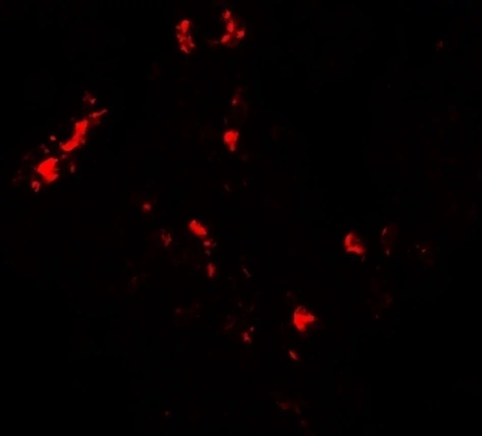 CMPK2 Antibody