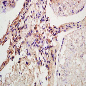 HSD17B3 Rabbit Polyclonal Antibody (PE)