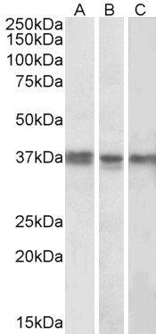 Goat anti-POLDIP2 Antibody