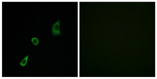 FGF23 antibody