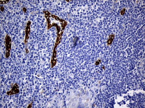 TM4SF2 Antibody