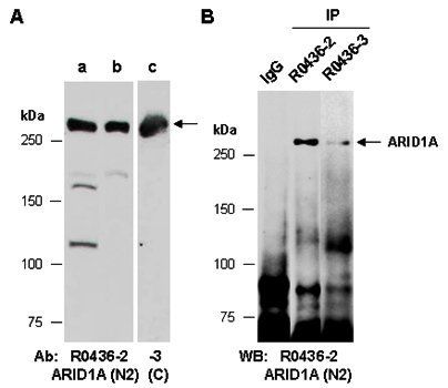 ARID1A antibody pairs