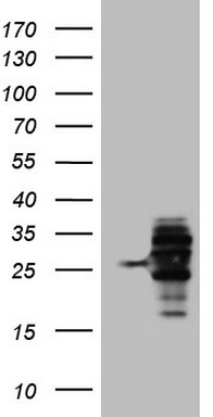 WIBG (PYM1) antibody