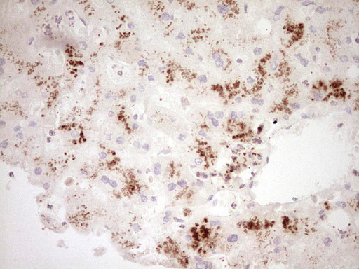 GLI4 Antibody