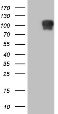 Glucocorticoid Receptor (NR3C1) antibody