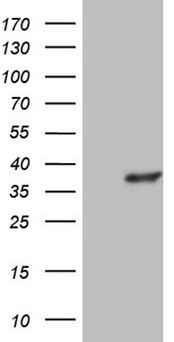 Gemin 8 Antibody