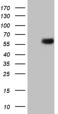 Estrogen Related Receptor beta (ESRRB) antibody