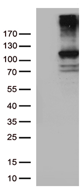 Rb (RB1) antibody