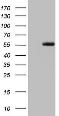 LRRTM1 Antibody