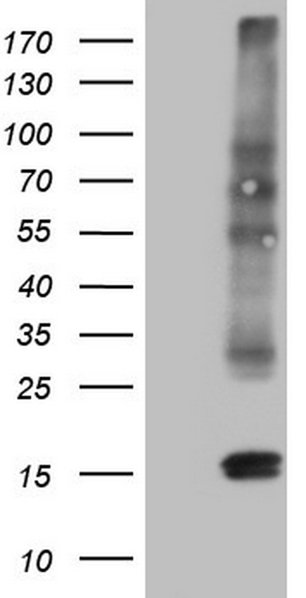 hCG beta (CGB3) antibody