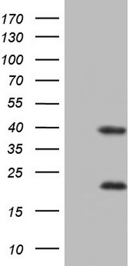 Constitutive androstane receptor (NR1I3) antibody