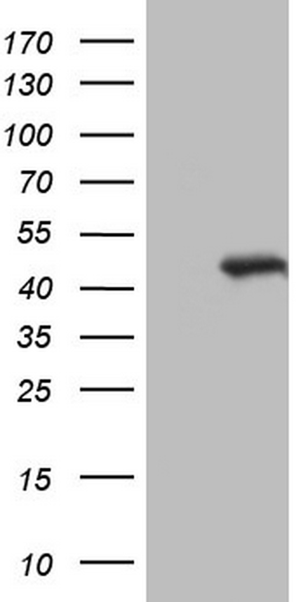 Constitutive androstane receptor (NR1I3) antibody