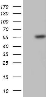 uPA Antibody