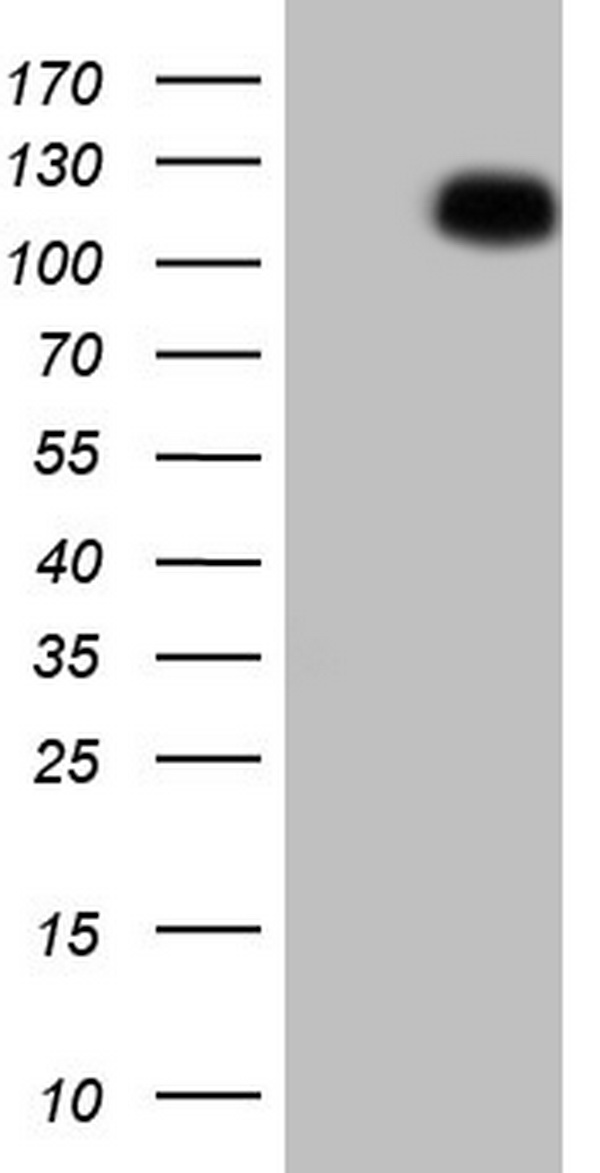 MRTFA Antibody