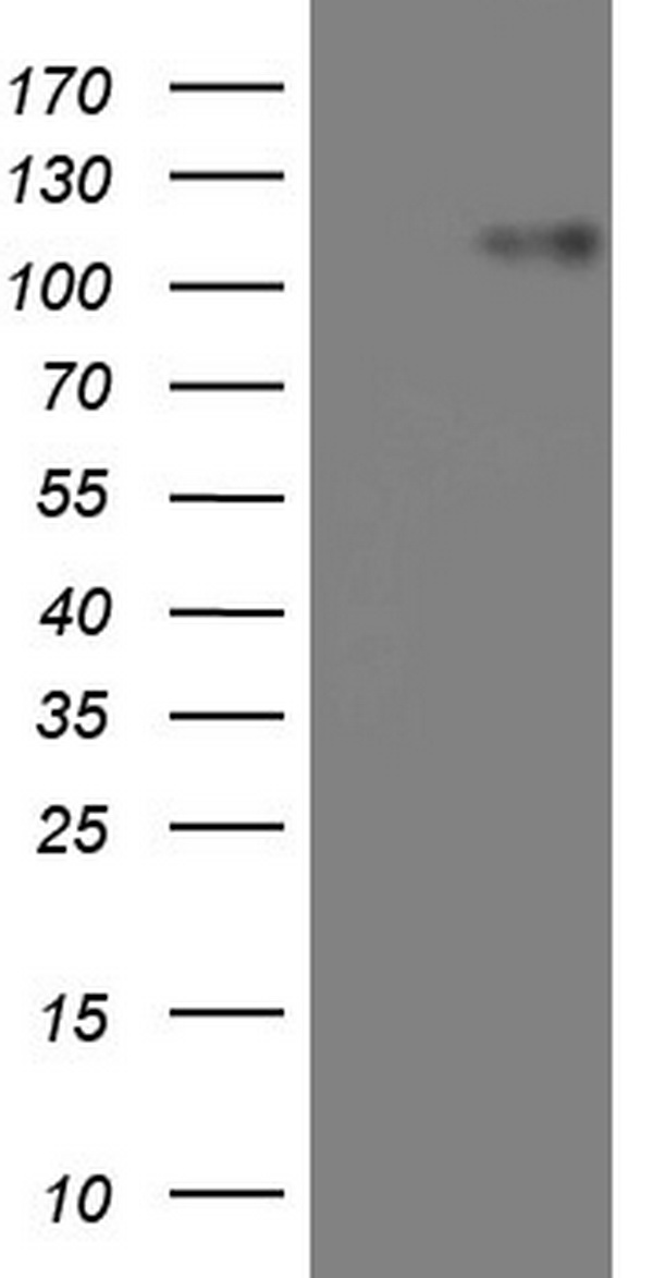 MRTFA Antibody