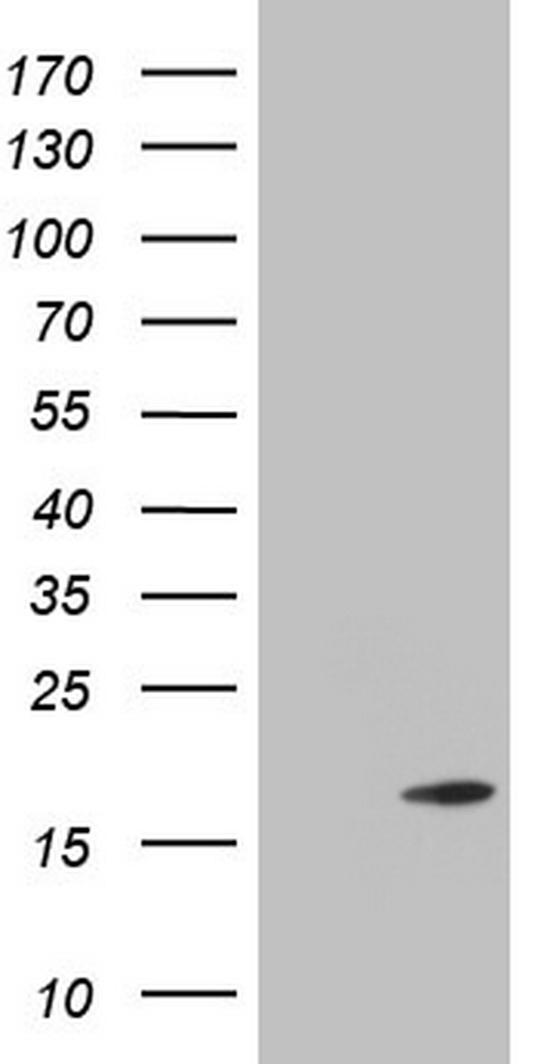 TWIST2 antibody