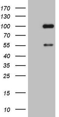 ADAMTS4 antibody
