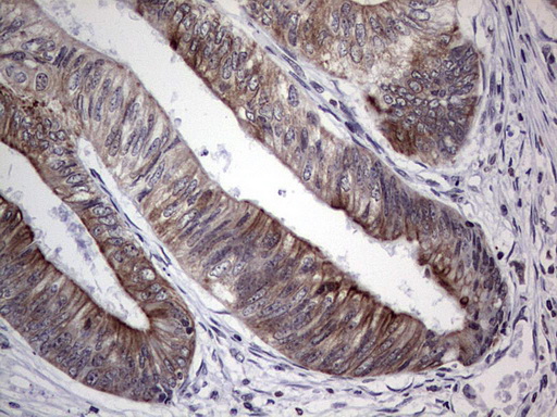 HIP55 Antibody