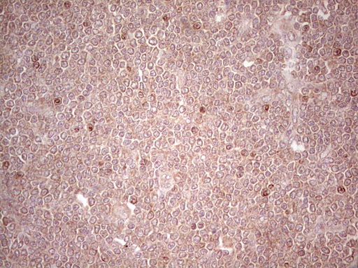 Lipin 3 Antibody