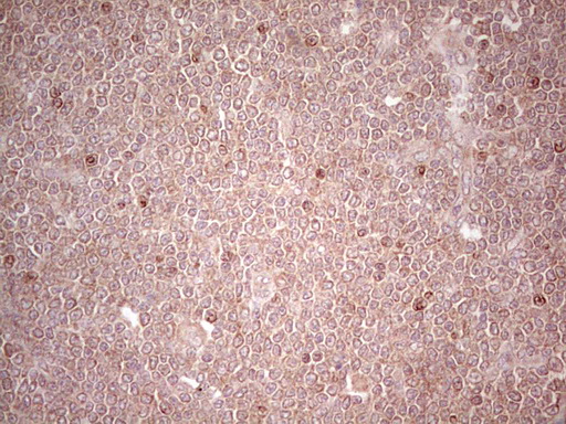 Lipin 3 (LPIN3) antibody