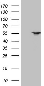 LXR alpha Antibody