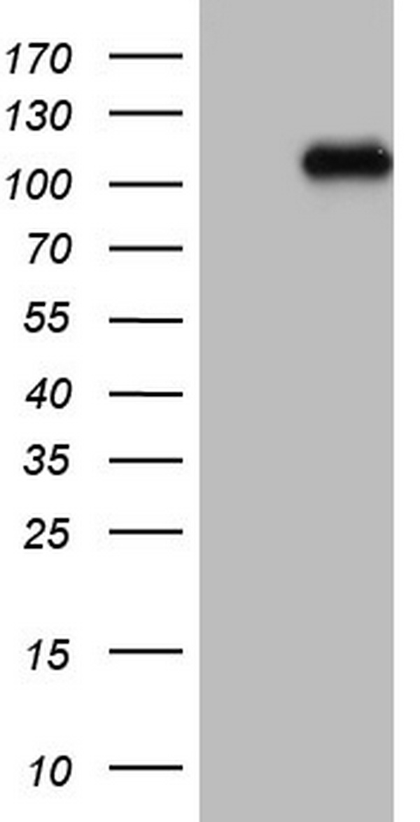 BRIT1 (MCPH1) antibody